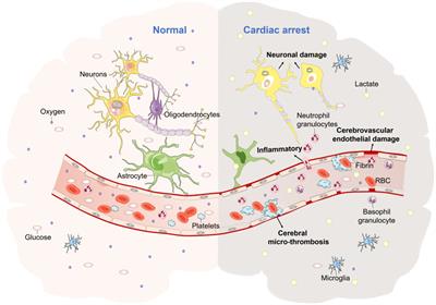 The effects of ECMO on neurological function recovery of critical patients: A double-edged sword